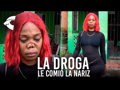LA DROGA LE COMIO LA NARIZ ! ERA LA MAS BELLA