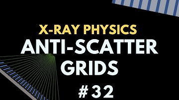 Anti-scatter grids | X-ray Physics | Radiology Physics Course #39
