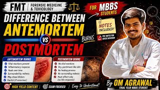 Difference between antemortem burns and post mortem burns| fmt| mbbs | forensic medicine| with notes