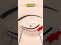 SURGERY ON YOUR FACE AND YOU DIDN’T EVEN KNOW! #animation #skincare #shorts #face #cosmeticsurgery