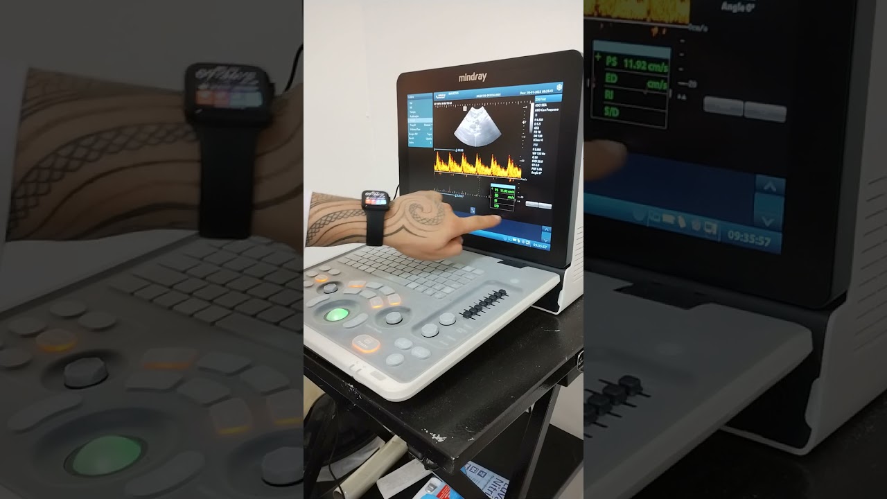 Medindo a frequência cardíaca fetal no Mindray Z50 Vet