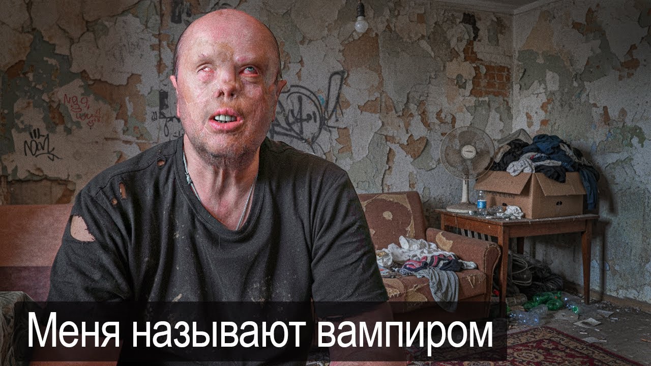 Я ХОЧУ ЖИТЬ КАК ВСЕ НОРМАЛЬНЫЕ ЛЮДИ.