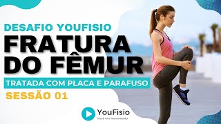 DESAFIO YOUFISIO PARA FRATURA DIAFISÁRIA DO FÊMUR TRATADA COM PLACA E PARAFUSO - SESSÃO 01