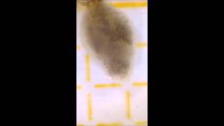 Flatworm attacked by parasites