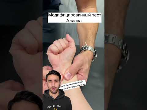 тест Аллена