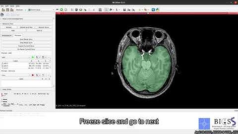 SAMM (Segment Any Medical Model): a 3D Slicer extension to Meta