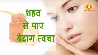 शहद से पाए बेदाग निखरी त्वचा | Beauty benefits of Honey | Honey for Glowing Skin | Insider Story screenshot 4