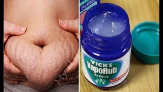 Use Vicks Vaporub To Get Rid of Accumulated Belly Fat Eliminate Cellulite/vicks vapor Rub flat