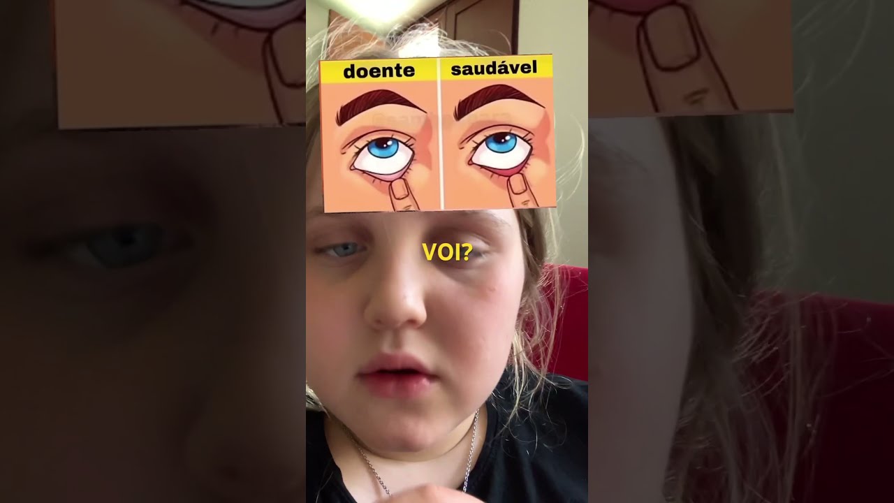 E Voi 