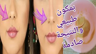 تصغير الأنف طبيعيا بعشر دقائق تنحيف بدون عملية تجميل