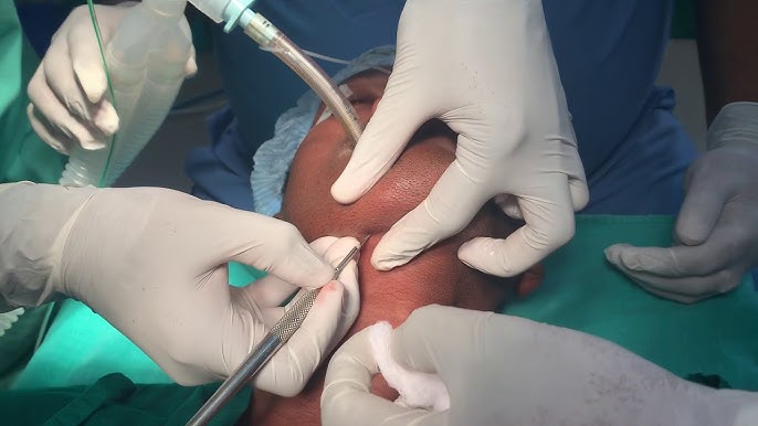 Erkakning qolini tirsagigacha mushtlash