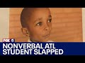 Atlanta teacher reported for slapping child with autism  fox 5 news