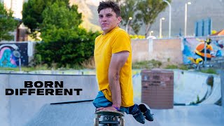 My Legs Don't Work - But I'm Still A Pro Skater | Born Different