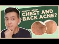 Get rid of CHEST & BACK ACNE: BEST PRODUCTS + DOs and DON'Ts! (Filipino) | Jan Angelo