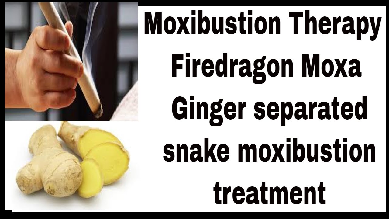Moxibustion Therapy.moxa.Firedragon Moxa, TCM,Ginger separated snake