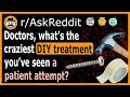 Doctors, what is the craziest DIY treatment you've seen a patient attempt? - (r/AskReddit)