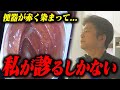 「腸の中に何故こんな物が!?」緊急事態で佐藤院長が内視鏡分院へ向かった理由とは!?