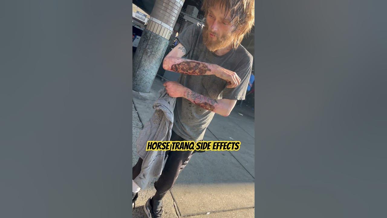 Horse Tranq Side Effects #addiction #thestreets #addict #viral