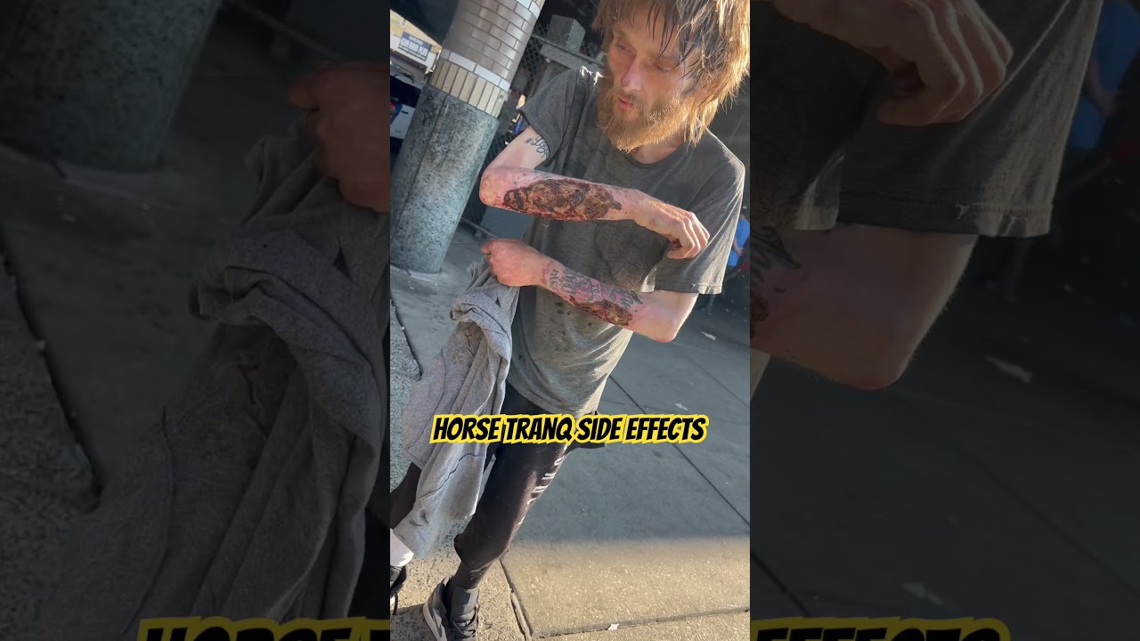 Horse Tranq Side Effects #addiction #thestreets #addict #viral