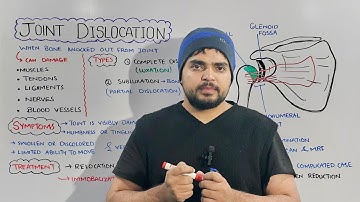 Joint Dislocation: Types, causes, symptoms, diagnosis and Treatments