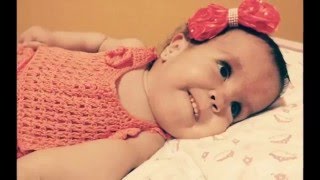 Displasia Campomelica Campomelic Dysplasia - Daphne Louise