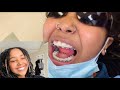 VLOG | GETTING MY BRACES OFF AFTER 6 YEARS