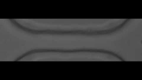 Human Blood Cells in a Microfluidic Constriction