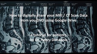 How to upload your MRI Scans (from DVD to PC to Google Drive) screenshot 3