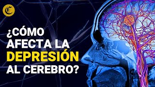 ¿CÓMO AFECTA LA DEPRESIÓN AL CEREBRO? Recomendaciones para ayudar a nuestro  a funcionar mejor