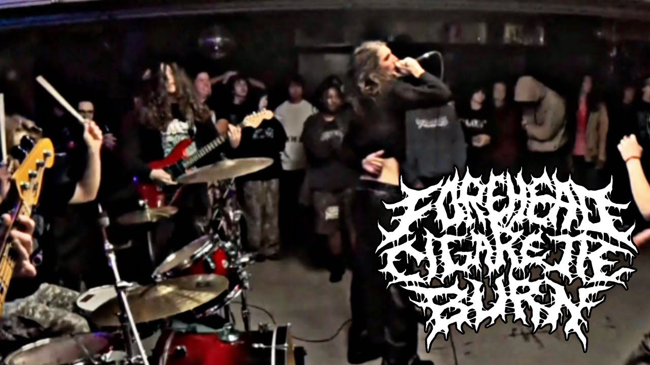 FOREHEAD CIGARETTE BURN - OKC / 11-21-25