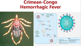 Crimean-Congo Hemorrhagic fever || CCHF || Cause, Symptoms, Diagnosis & Prevention of CCHF screenshot 1