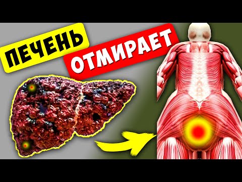 15 Признаков того, что Ваша ПЕЧЕНЬ ОТМИРАЕТ! 90 даже НЕ Догадываются...