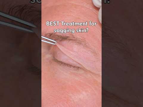 How to fix SAGGING SKIN #skincare #beauty #eyes #treatment