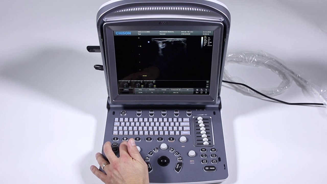 Chison ECO5/ECO6 Training Part 5: Reports and Exporting