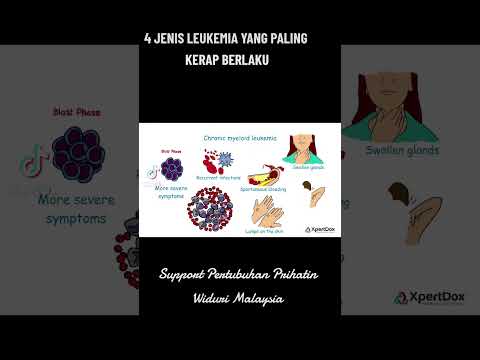 Video: Leukemia yang paling biasa di kalangan kanak-kanak