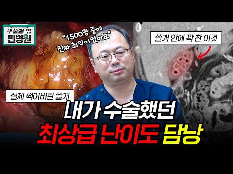 명치, 윗배 통증 방치하면 100% 이렇게 됩니다, 쓸개 터지기 전에 검사 받아야 하는 이유