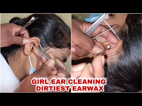 Indian Barber,Girl Ear cleaning By Indian Street barber very dirty Ear very Satisfing Video 💤 😴 Asmr