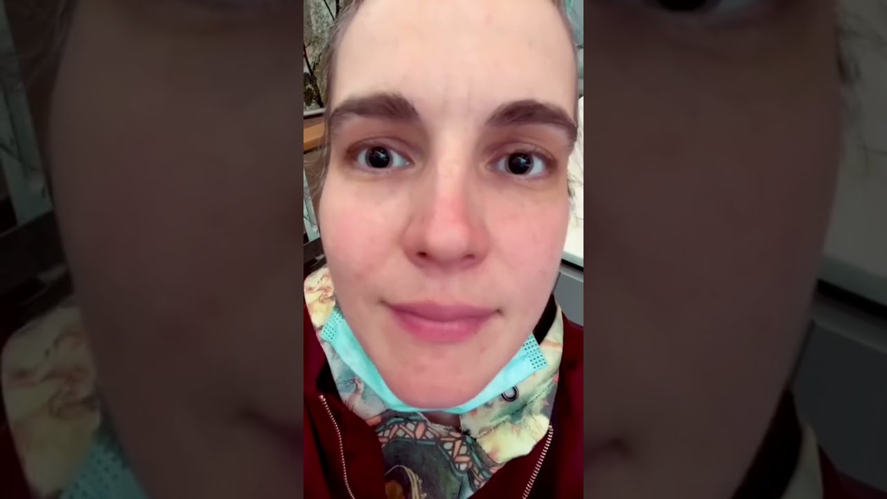 Dilated pupils My eyes before and after dilation! YouTube