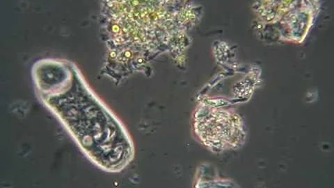 Come vedere un batterio al microscopio?