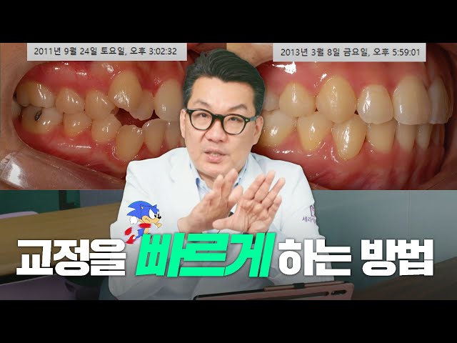 돌출입 치아 교정을 1년 반 안에 끝낼 수 있는 방법은