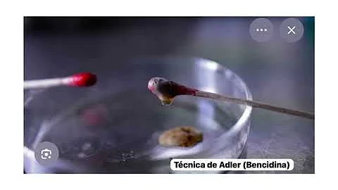 Química forense, hematologia y toxicologia