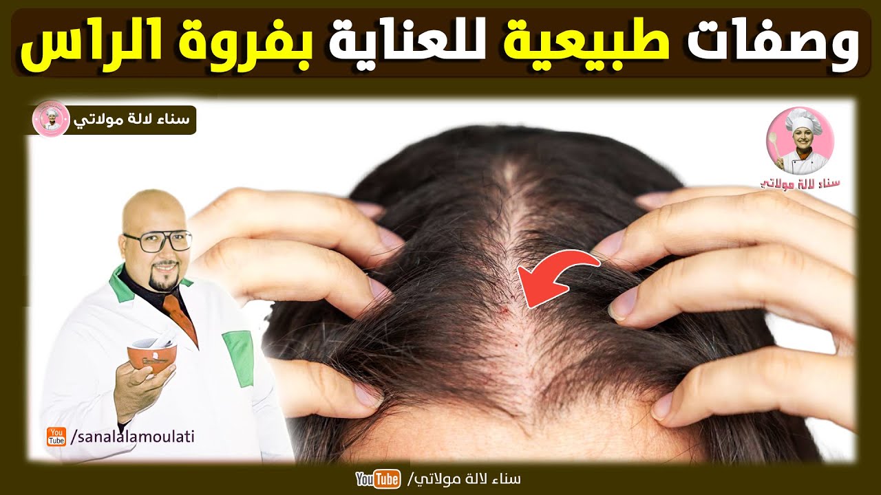 وصفات طبيعية للعناية بفروة الراس وتقويتها / وصفات الدكتور عماد ميزاب