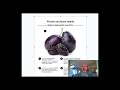 Prunes For Bone Health