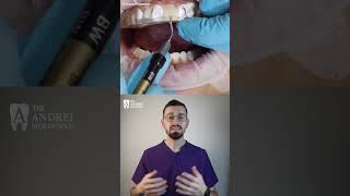 Tehnica De Injectare A Compozitului Este O Metodă Modernă, Precisă Și Estetică