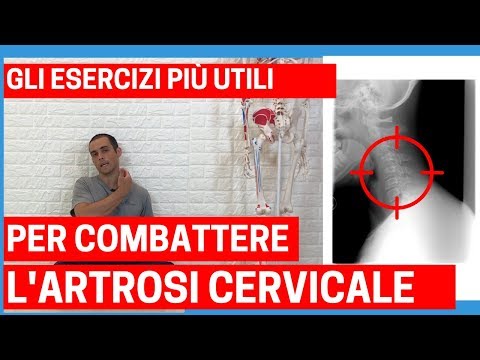 Video: Artrosi Dell'articolazione Della Spalla: Sintomi, Trattamento, Ginnastica, Esercizi