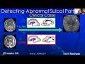 ISPD Virtual Education Series -  Session 5: Functional Imaging