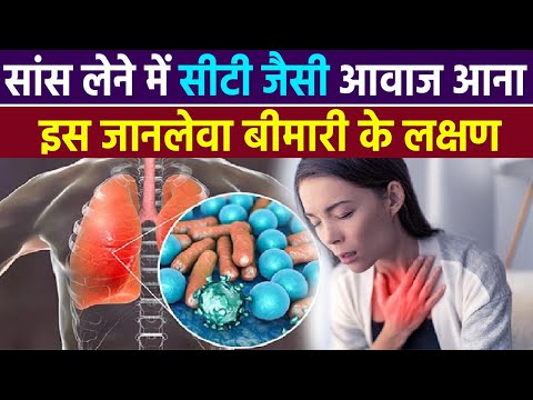 वीडियो: साँस लेते समय स्ट्राइडर होता है?