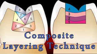 Composite Layering Techniques | The Best Composite Layering Technique