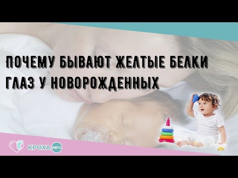 Почему бывают желтые белки глаз у новорожденных