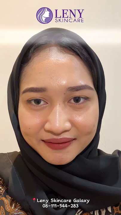 2025 waktunya glow up dengan treatment dari leny skincare